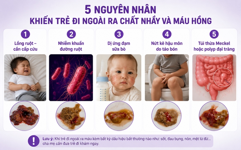 5 nguyên nhân điển hình khiến trẻ đi ngoài ra máu hồng & chất nhầy