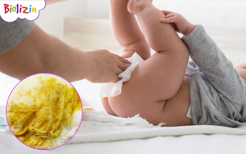 cách chữa đi ngoài phân sống bằng dân gian 1