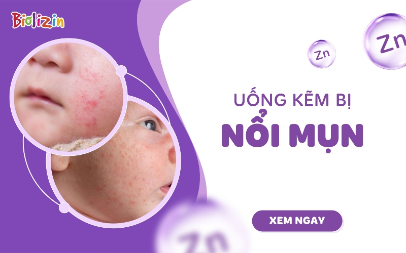trẻ uống kẽm bị nổi mụn không