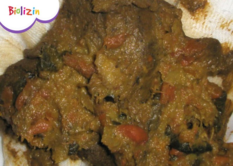 Hình ảnh đi ngoài phân sống ở trẻ 2