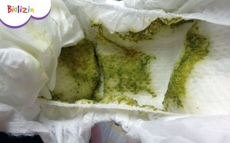 Hình ảnh đi ngoài phân sống ở trẻ 5