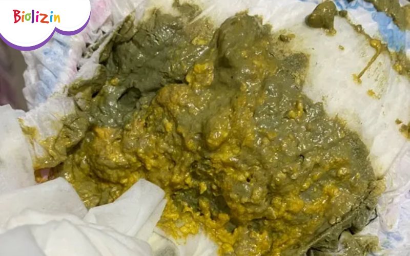 Hình ảnh đi ngoài phân sống ở trẻ 7